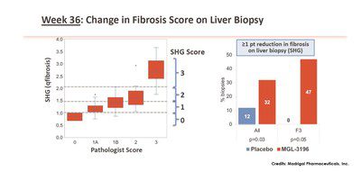 HistoIndex’s Second Harmonic Generation (SHG) Technology: A Potentially Important Tool Used In Madrigal’s Phase 2 Nonalcoholic Steatohepatitis (NASH) Clinical Trial