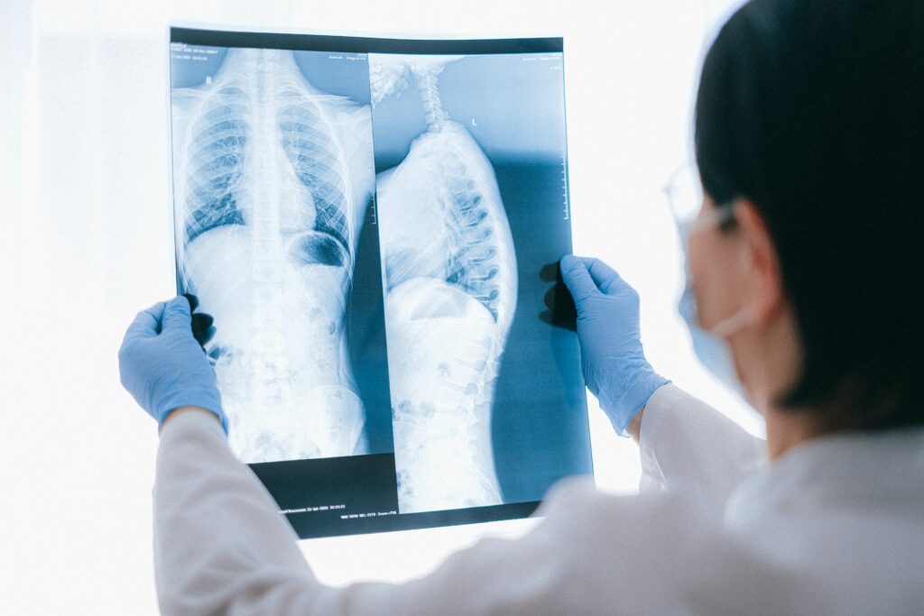 ALTY Orthopaedic Hospital and Viatris drive awareness on scoliosis