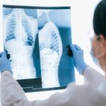 ALTY Orthopaedic Hospital and Viatris drive awareness on scoliosis